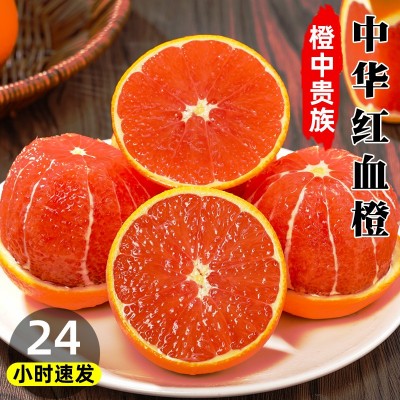 血橙新鲜水果9斤秭归中华红橙子当季红心甜脐整箱红心大果红肉5橙图3