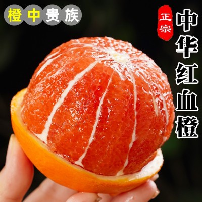 血橙新鲜水果9斤秭归中华红橙子当季红心甜脐整箱红心大果红肉5橙图2
